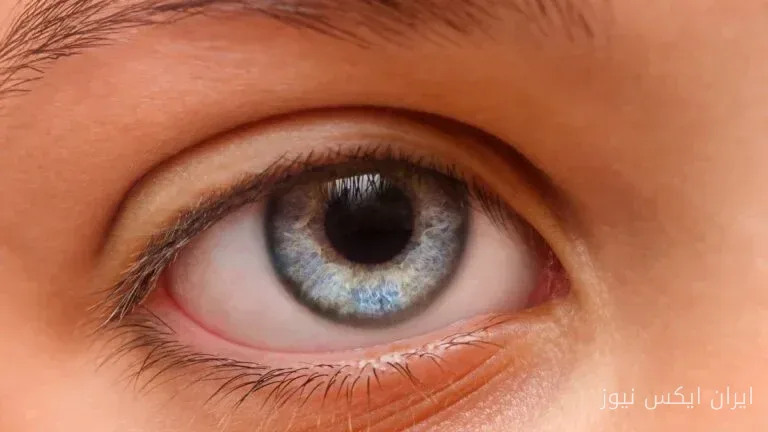 چشم‌ها ممکن است ADHD را لو بدهند؛ کشف سرنخی تازه در مردمک چشم